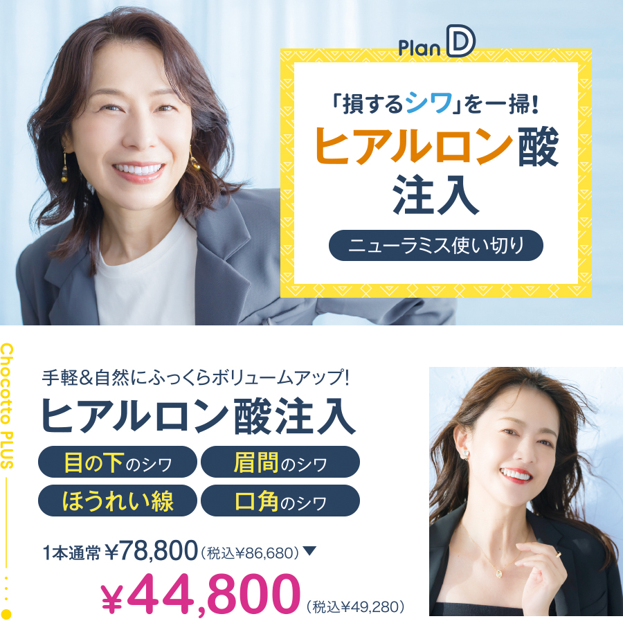 プランD