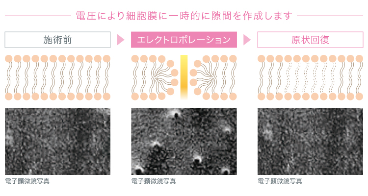 エレクトロポレーション説明図_01