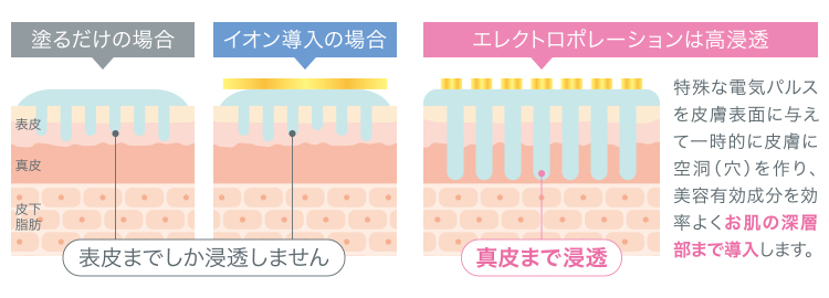 エレクトロポレーション説明図_02